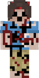 Omermete1545
