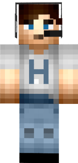 Harry's skin