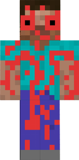3R
