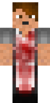 sdh