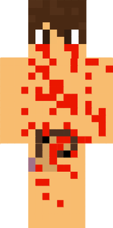 Kill noob