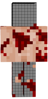 bloody body