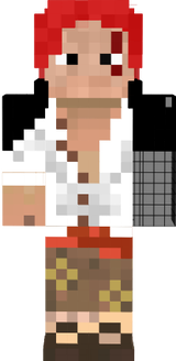 shanks
