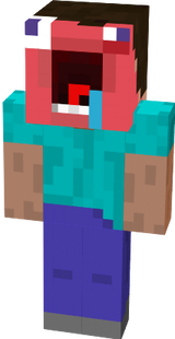 Steve in pain
