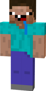 steve com sidrome de down