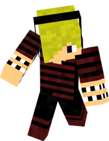 Austin's Skin 