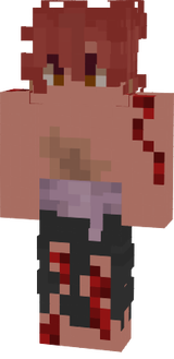 Catapimbas