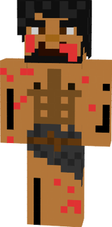 uhi