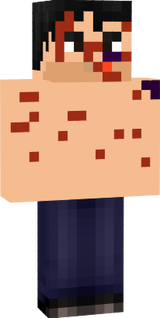 pokesmon bruce machucado