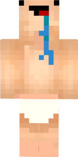 retrad