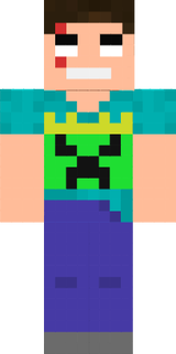 xd
