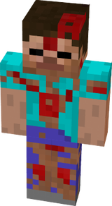 Diseased LeSteve v2