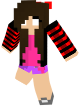 SunBurnedGirl