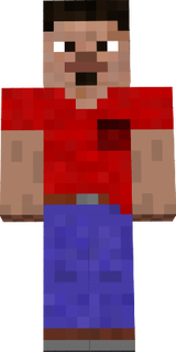 Gonzalo's skin