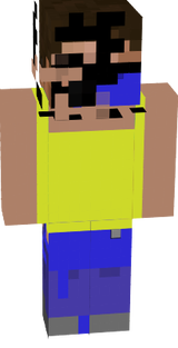 Steve got sunburn at beach