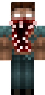 dth
