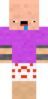 xBert
