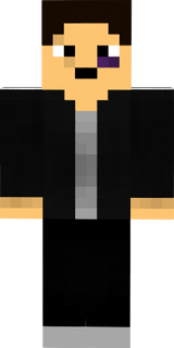 RC