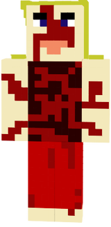 dyna