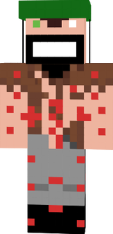 super notch
