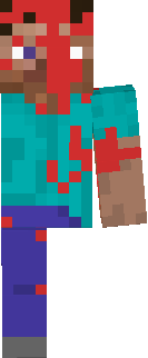 Injured steve