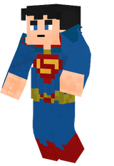 Bvs