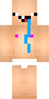 iodiot