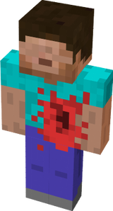 Bloody dead steve