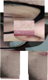 egazz1