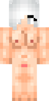 mcpr