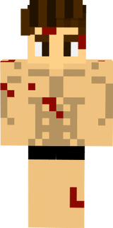 Battle Damaged lol