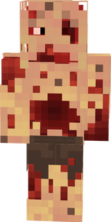 plague