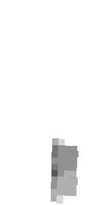 leg cast