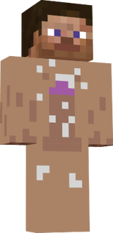 NIG