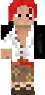shanks
